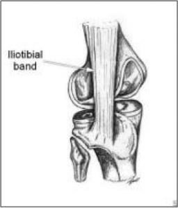 Iliotibial band at the lateral femoral condyle, with the posterior fibers denoted.